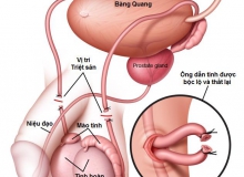 ĐIỀU ĐÁNG NGẠC NHIÊN SAU TRIỆT SẢN NAM